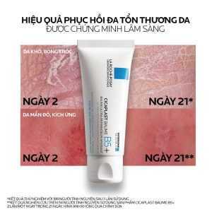 Kem phục hồi đa năng La Roche-Posay Cicaplast Baume B5+ phiên bản 40ml 6 - 300