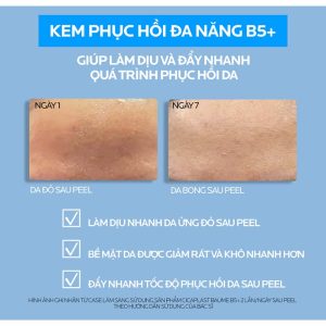 Kem phục hồi đa năng La Roche-Posay Cicaplast Baume B5+ phiên bản 40ml 9 - 300